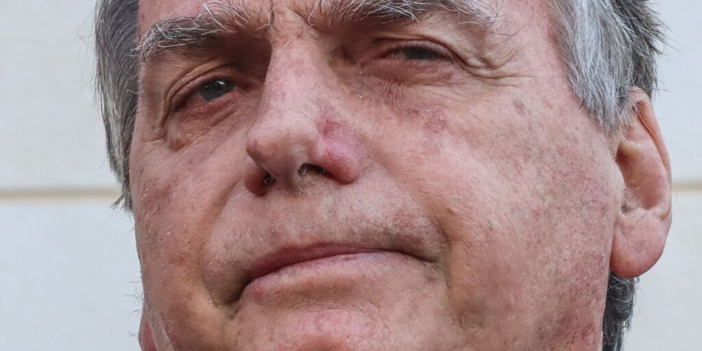 Bolsonaro apresenta piora clínica e vai passar por novos exames